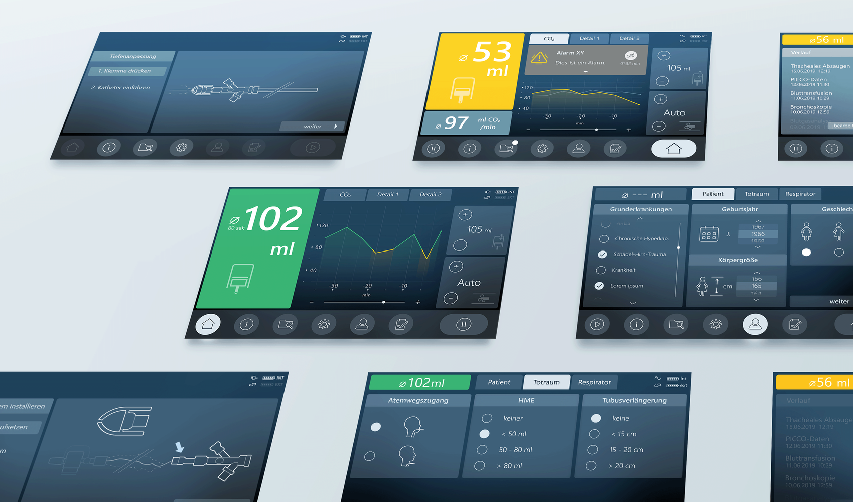 User Interface Design der Gründler Ventilution für die künstliche Beatmung, Übersicht der Bildschirmansichten
